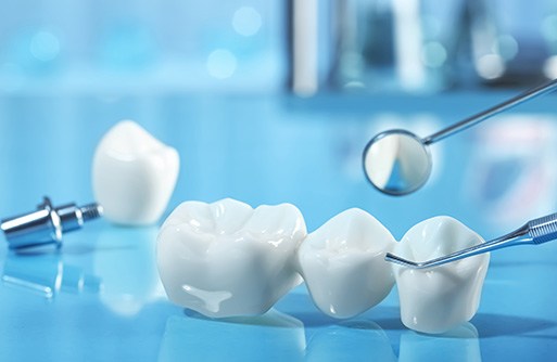 Shiny dental bridge and implant on a reflective blue surface with dental instruments