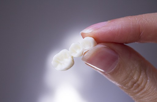 Fingers holding an implant bridge with 3 artificial teeth